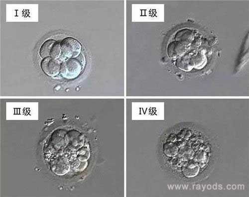 民和回族土族自治县华博助孕基金_试管胚胎等级分类，二级胚胎是不是优质胚